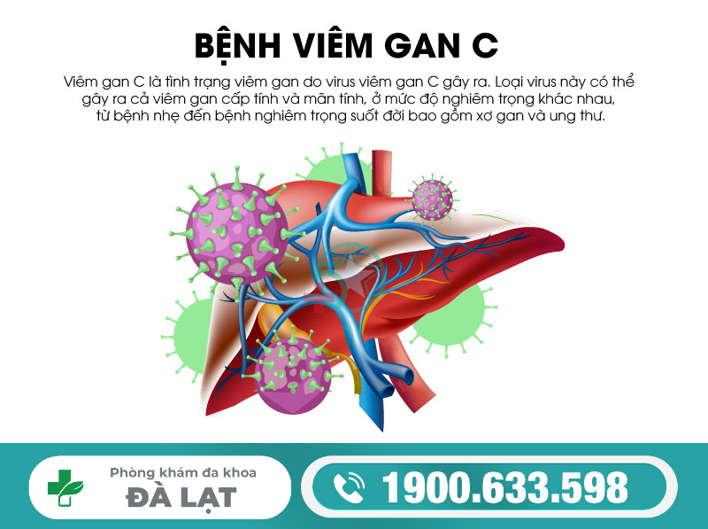 Hình ảnh minh họa